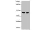 Western blot<br />
All lanes: ACADL antibody at 8ug/ml<br />
Lane 1 : Mouse kidney tissue<br />
Lane 2 : Mouse heart tissue<br />
Secondary<br />
Goat polyclonal to Rabbit IgG at 1/10000 dilution<br />
Predicted band size: 48 kDa<br />
Observed band size: