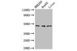Western Blot<br />
Positive WB detected in:HEK293 whole cell lysate,HepG2 whole cell lysate,Rat liver tissue<br />
All lanes:ACADSB antibody at 3