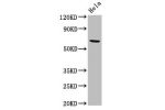 Western Blot<br />
Positive WB detected in:Hela whole cell lysate<br />
All lanes:ACADVL antibody at 2