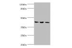 Western blot<br />
All lanes:ACAT1 antibody at 6ug/ml<br />
Lane 1:mouse skeletal musce tissue<br />
Lane 2:rat heart tissue<br />
Lane 3:THP-1 whole cell lysate<br />
Secondary<br />
Goat polyclonal to rabbit at 1/10000 dilution<br />
Predicted band size