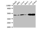 Western Blot<br />
Positive WB detected in:HepG2 whole cell lysate,K562 whole cell lysate,Rat liver tissue,Mouse heart tissue,Mouse liver tissue Mouse kindey tissue<br />
All lanes:ACAT1 antibody at 3