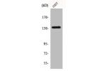Western Blot analysis of COS7 cells using Abl1 Polyclonal Antibody