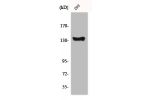 Western Blot analysis of 293 cells using c-Abl Polyclonal Antibody