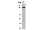 Western Blot analysis of COLO205 cells using Cadherin-18 Polyclonal Antibody