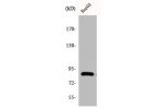Western Blot analysis of COLO205 cells using Cadherin-19 Polyclonal Antibody