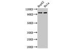 Western Blot<br />
Positive WB detected in:HepG2 whole cell lysate,Hela whole cell lysate<br />
All lanes:ACO1 antibody at 3