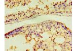 Immunohistochemistry of paraffin-embedded human testis using CSB-PA001186DSR2HU at dilution 1:100