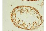 Immunohistochemistry of paraffin-embedded human testis tissue using CSB-PA001186HA01HU at dilution of 1:100