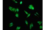 Immunofluorescent analysis of HepG2 cells using CSB-PA001191LA01HU at a dilution of 1:100 and Alexa Fluor 488-congugated AffiniPure Goat Anti-Rabbit IgG(H+L)