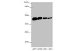Western blot<br />
All lanes
