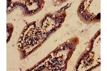 Immunohistochemistry analysis of human small intestine tissue using CSB-PA001207NJ01HU at dilution of 1:100