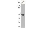 Western Blot analysis of COLO205 cells using CAR Polyclonal Antibody