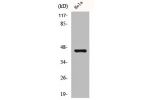 Western Blot analysis of Jurkat cells using Casein Kinase IIa Polyclonal Antibody
