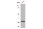 Western Blot analysis of HuvEc cells using Casein Kinase II