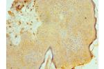 Immunohistochemistry of paraffin-embedded human skin using CSB-PA001237ESR1HU at dilution 1:100