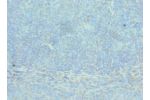 Immunohistochemistry of paraffin-embedded human tonsil using CSB-PA001248ESR2HU at dilution 1:100