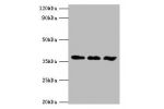 Western blot<br />
All lanes:ACVR1 antibody at 6ug/ml<br />
Lane 1:A549 whole cell lysate<br />
Lane 2:HepG2 whole cell lysate<br />
Lane 3:mouse gonad tissue<br />
Secondary<br />
Goat polyclonal to rabbit at 1/10000 dilution<br />
Predicted band size: 3