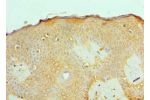 Immunohistochemistry of paraffin-embedded human skin using CSB-PA001260ESR1HU at dilution 1:100