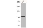 Western Blot analysis of HeLa cells using Catenin-a E/N Polyclonal Antibody