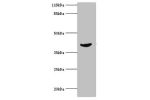 Western blot<br />
All lanes: ADA antibody at 2ug/ml+jurkat whole cell lysate<br />
Secondary<br />
Goat polyclonal to rabbit at 1/10000 dilution<br />
Predicted band size: 41kDa<br />
Observed band size: 41kDa<br />