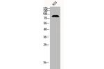 Western Blot analysis of 823 cells using Catenin-