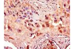 Immunohistochemistry of paraffin-embedded human placenta tissue using CSB-PA001275LA01HU at dilution of 1:100
