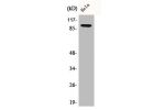 Western Blot analysis of HeLa cells using Catenin-