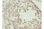 Immunohistochemistry of paraffin-embedded human testis tissue using CSB-PA001300LA01HU at dilution of 1:100