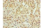 Immunohistochemistry of paraffin-embedded human adrenal gland using CSB-PA001322DSR1HU at dilution 1:100