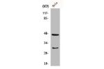 Western Blot analysis of K562 cells using Cathepsin D Polyclonal Antibody
