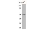 Western Blot analysis of HepG2 cells using Cathepsin E Polyclonal Antibody