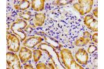 Immunohistochemistry of paraffin-embedded human kidney tissue using CSB-PA001342LA01HU at dilution of 1:100