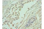 Immunohistochemistry of paraffin-embedded human prostate using CSB-PA001348ESR1HU at dilution 1:100