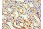 Immunohistochemistry of paraffin-embedded human kidney using CSB-PA001356ESR2HU at dilution 1:100