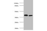 Western blot<br />
All lanes: Alcohol dehydrogenase class-3 antibody at 2ug/ml<br />
Lane 1: mouse liver tissue<br />
Lane 2: mouse kidney tissue<br />
Secondary<br />
Goat polyclonal to Rabbit IgG at 1/10000 dilution<br />
Predicted band size: 40kDa<br /