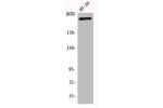 Western Blot analysis of HT29 cells using CBP Polyclonal Antibody