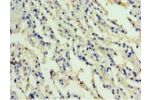 Immunohistochemistry of paraffin-embedded human lung tissue using CSB-PA001370HA01HU at dilution 1:100