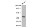 Western Blot<br />
Positive WB detected in:Mouse brain tissue<br />
All lanes: ADORA2B antibody at 3ug/ml<br />
Secondary<br />
Goat polyclonal to rabbit IgG at 1/50000 dilution<br />
Predicted band size: 37 kDa<br />
Observed band size: 37 kDa<br />