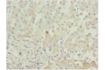 Immunohistochemistry of paraffin-embedded human liver tissue using CSB-PA001380ESR1HU at dilution 1:100
