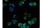 Immunofluorescent analysis of MCF-7 cells using CSB-PA001388LA01HU at a dilution of 1:100 and Alexa Fluor 488-congugated AffiniPure Goat Anti-Rabbit IgG(H+L)
