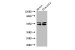 Western Blot<br />
Positive WB detected in:Mouse brain tissue,Human placenta tissue<br />
All lanes: ADRB1 antibody at 3ug/ml<br />
Secondary<br />
Goat polyclonal to rabbit IgG at 1/50000 dilution<br />
Predicted band size: 52 kDa<br />
Observed band siz
