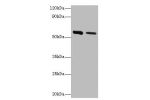 All lanes:Adenylosuccinate lyase antibody at 2ug/ml<br />
Lane 1:Hela whole cell lysate<br />
Lane 2:mouse heart tissue<br />
Secondary<br />
Goat polyclonal to rabbit at 1/10000 dilution<br />
Predicted band size: 55,49 kDa<br />
Observed band size: 55 k