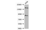 Western Blot<br />
Positive WB detected in:A549 whole cell lysate<br />
All lanes:AFF2 antibody at 5
