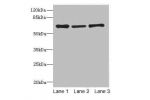 Western blot<br />
All lanes: Alpha-fetoprotein antibody at 10ug/ml<br />
Lane 1 : HepG-2 whole cell lysate<br />
Lane 2 : Rat liver tissue<br />
Lane 3 : 293T whole cell lysate<br />
Secondary<br />
Goat polyclonal to Rabbit IgG at 1/10000 dilution<br />