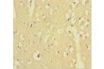 Immunohistochemistry of paraffin-embedded human brain tissue using CSB-PA001422LA01HU at dilution 1:100