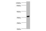 Western blot<br />
All lanes:N(4)-(beta-N-acetylglucosaminyl)-L-asparaginase antibody at 2ug/ml+mouse muscle tissue<br />
Secondary<br />
Goat polyclonal to rabbit at 1/10000 dilution<br />
Predicted band size: 37kDa<br />
Observed band size: 37kDa<br />