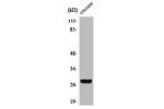 Western Blot analysis of COLO205 cells using CD160 Polyclonal Antibody