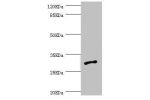 Western blot<br />
All lanes:AGPAT2 antibody at 1.09ug/ml+Jurkat whole cell lysate<br />
Secondary<br />
Goat polyclonal to rabbit at 1/10000 dilution<br />
Predicted band size: 31,28 kDa<br />
Observed band size: 31 kDa<br />