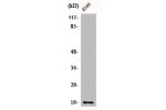 Western Blot analysis of A549 cells using CD3-d Polyclonal Antibody