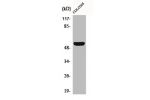 Western Blot analysis of COLO205 cells using CD4 Polyclonal Antibody